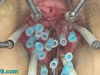 Advanced German Sadism & masochism Give a waggle medial Slit Cervix enhanced apart from Jugs